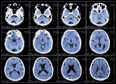 brain