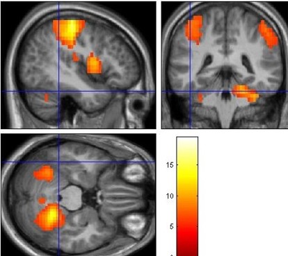 fmri-paty